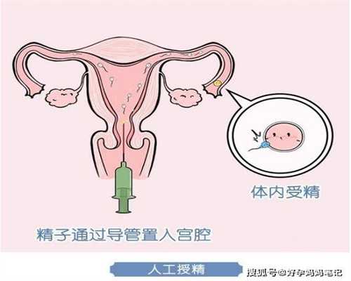 孕期5个问题，关系到胎儿和母体健康，有必要知