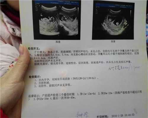 产妇孕期怎样合理安排B超检查