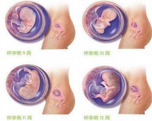 深圳供卵助孕,这4种食物孕期要少吃，过量进食对