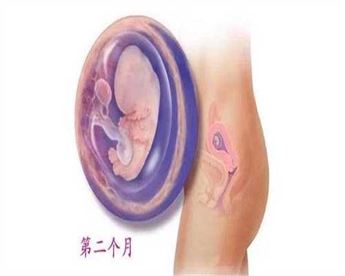 深圳助孕流程,诊疗胎记需要注意什么
