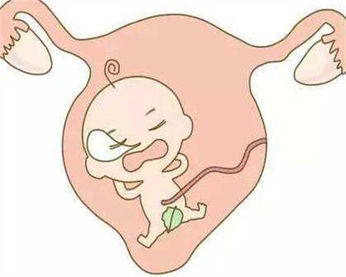 深圳代妈生子,多囊卵巢综合征促排后怀孕几率高