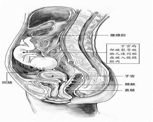深圳代孕网哪个正规,孕妇肚脐凸出来，还是凹进