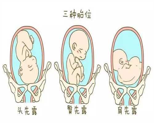 深圳正规代孕医院价格表_生儿生女哪个更幸福？