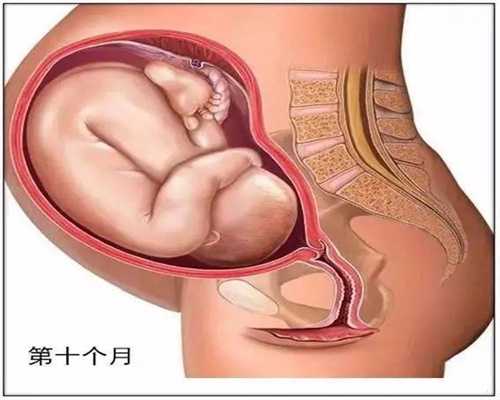 深圳代孕医院价格表_第一胎剖腹产第二胎可以顺