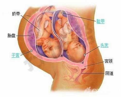 深圳哪个代孕网站可靠_胎儿侧脑室后角宽