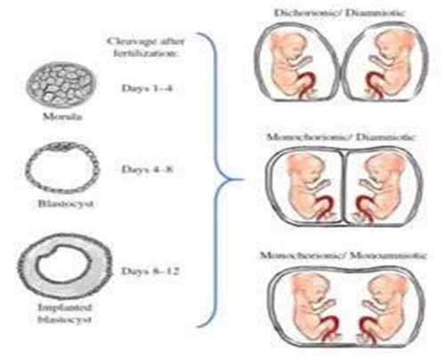 深圳代孕中介哪家靠谱：女人必学的乳房自检详细步骤